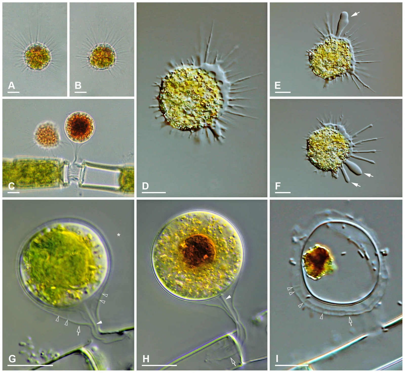 Microscopy composite of Vampyrella pendula feeding cells and digestive cyst stages, Hess, Sausen and Melkonian 2012 figure 3