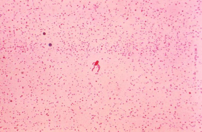 Pink field containing a small stained rod-shaped bacterium near the centre, with several fine flagella visible around it.