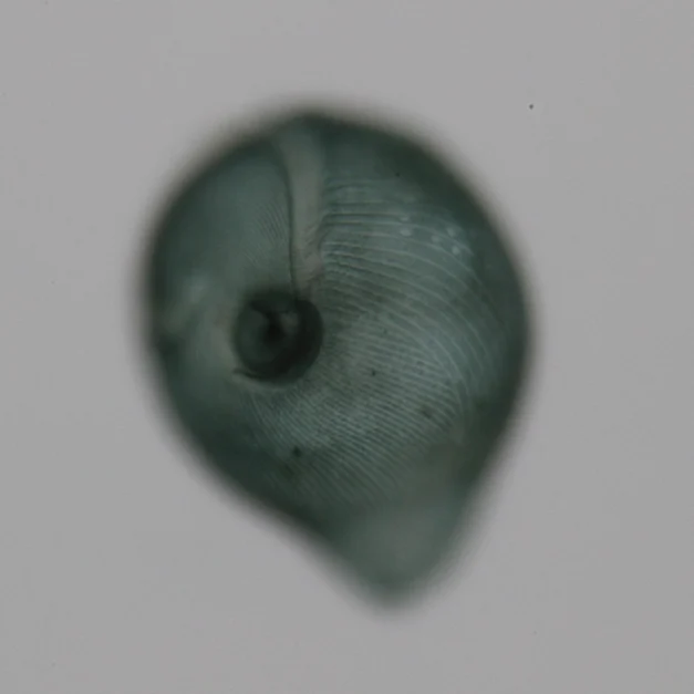Brightfield micrograph of a single Stentor coeruleus cell with visible cortical stripes, photographed by Mark M. Slabodnick