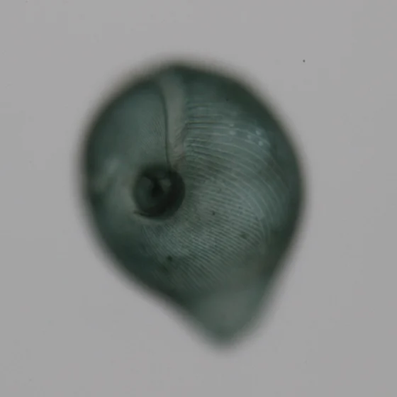 Brightfield micrograph of a single Stentor coeruleus cell with visible cortical stripes, photographed by Mark M. Slabodnick