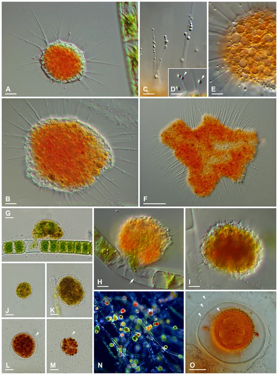 Microscopy composite of Vampyrella lateritia feeding cells and digestive cyst stages, Hess, Sausen and Melkonian 2012 figure 2