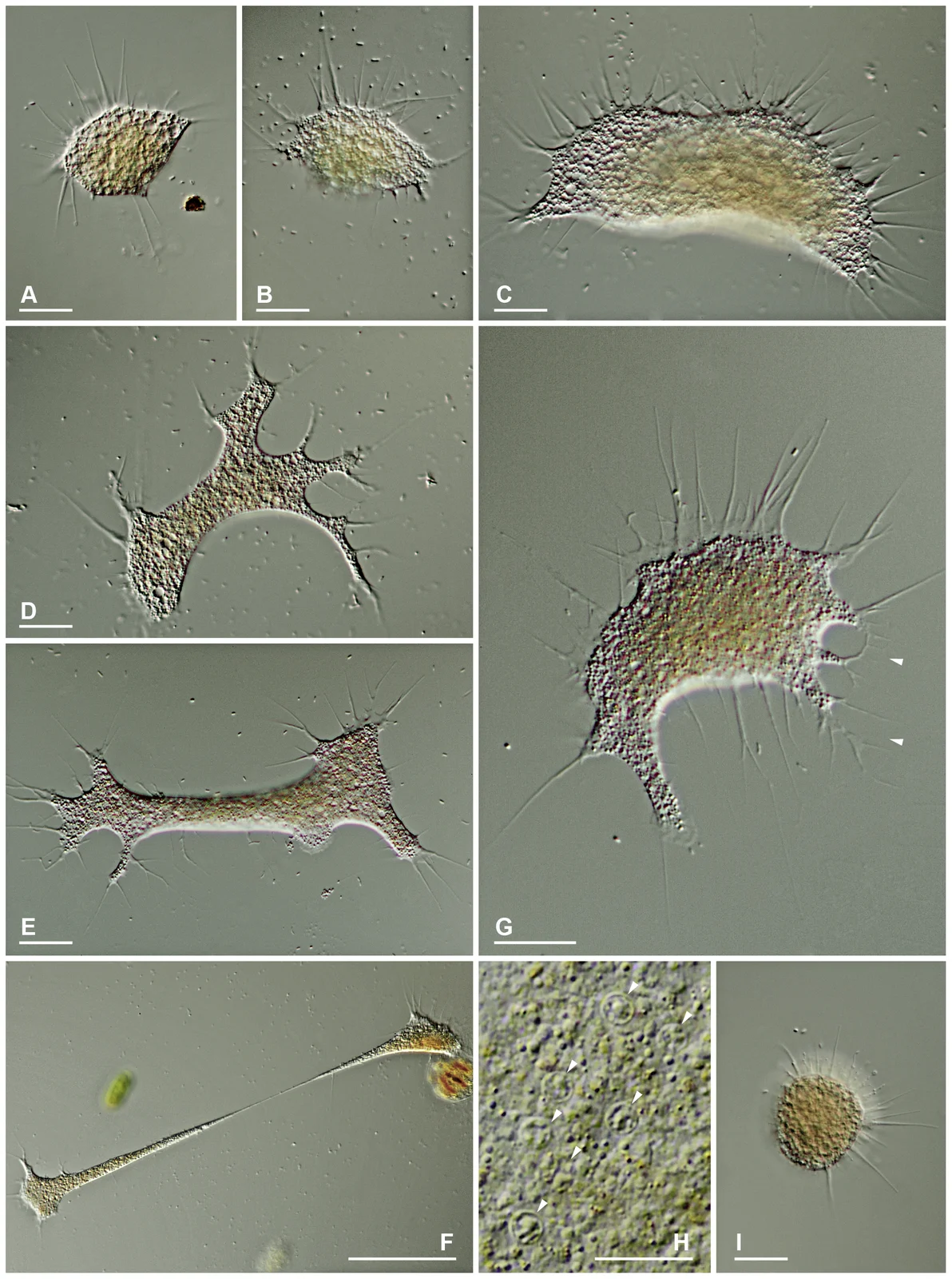 Differential-interference-contrast micrographs of Leptophrys vorax feeding cells in several shapes, Hess, Sausen and Melkonian 2012 figure4