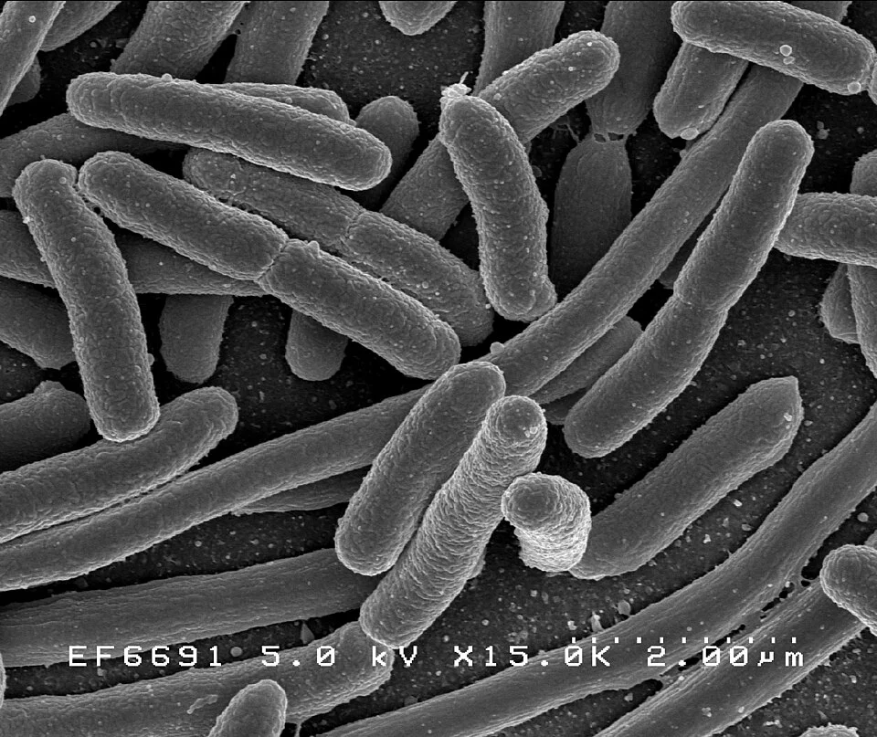 Scanning electron micrograph of Escherichia coli, grown in culture and adhered to a cover slip. Credit: NIAID