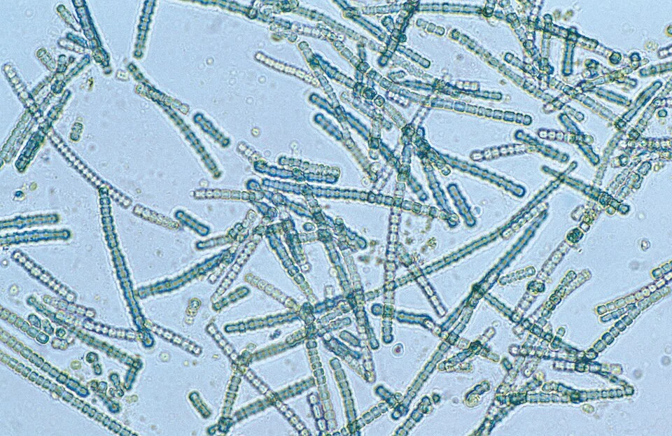 A blue-green algae species – Cylindrospermum sp – under magnification at the Adelaide laboratories of CSIRO Land and Water, 1993.