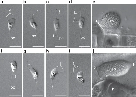 Amoeboradix gromovi cells in lower panels f–j, compared with Sanchytrium tribonematis in upper panels a–e
