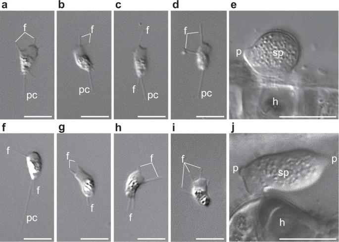Sanchytrium tribonematis cells in upper panels a–e, compared with Amoeboradix gromovi in lower panels f–j