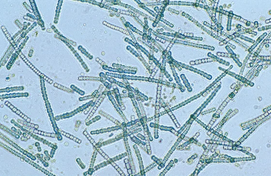 A blue-green algae species – Cylindrospermum sp – under magnification at the Adelaide laboratories of CSIRO Land and Water, 1993.