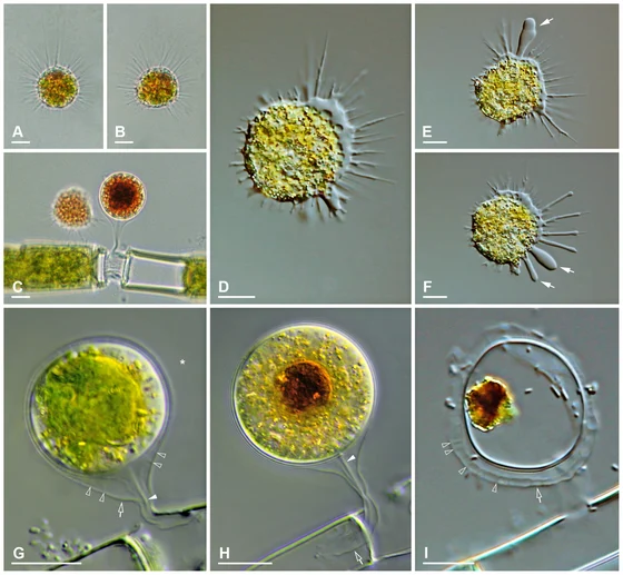 Microscopy composite of Vampyrella pendula feeding cells and digestive cyst stages, Hess, Sausen and Melkonian 2012 figure 3